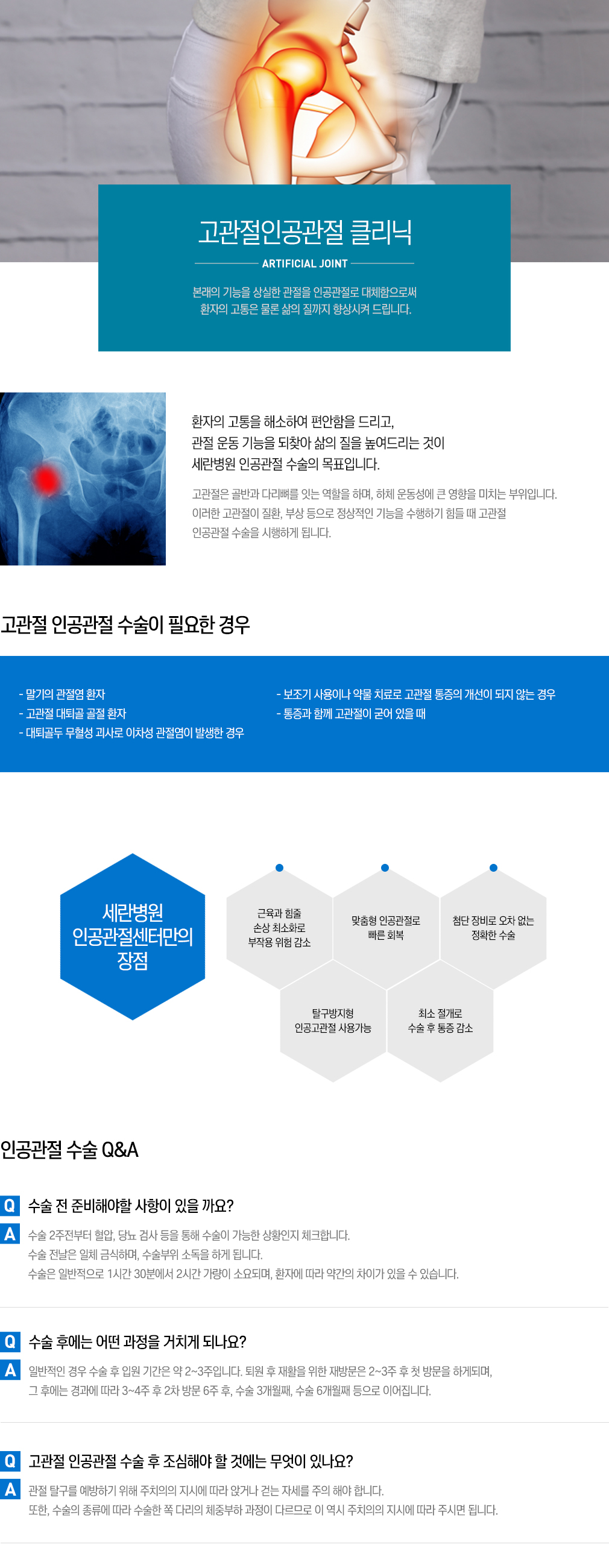 무릎인공관절클리닉