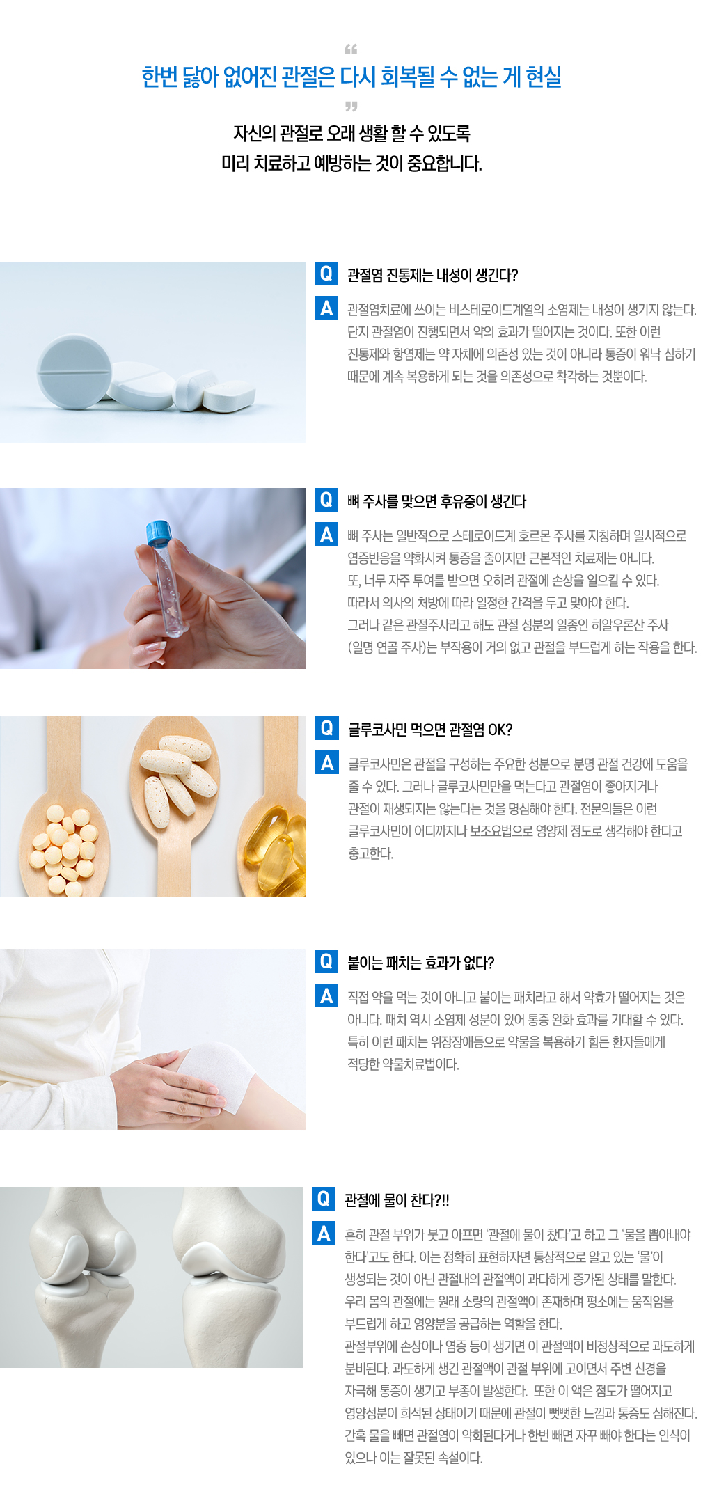 관절염 치료 FAQ