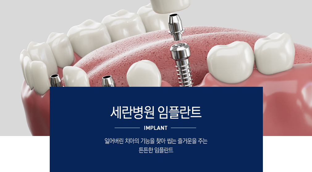 임플란트가 필요한 경우