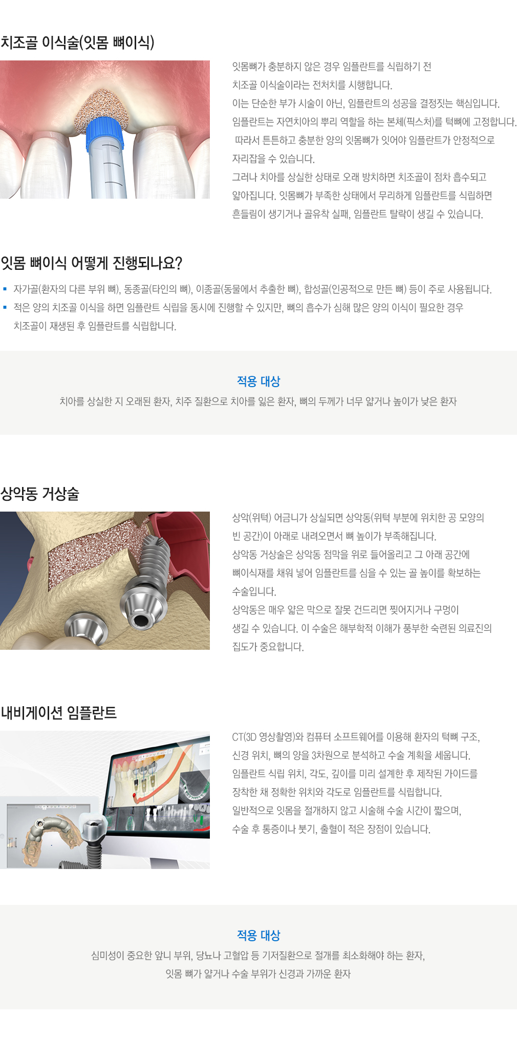 임플란트 수술