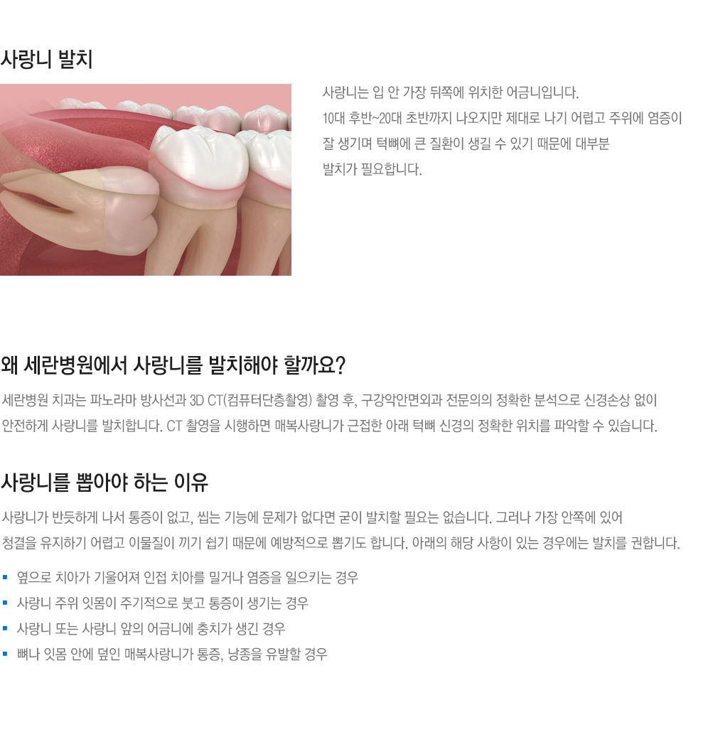 사랑니를 뽑아야 하는 이유