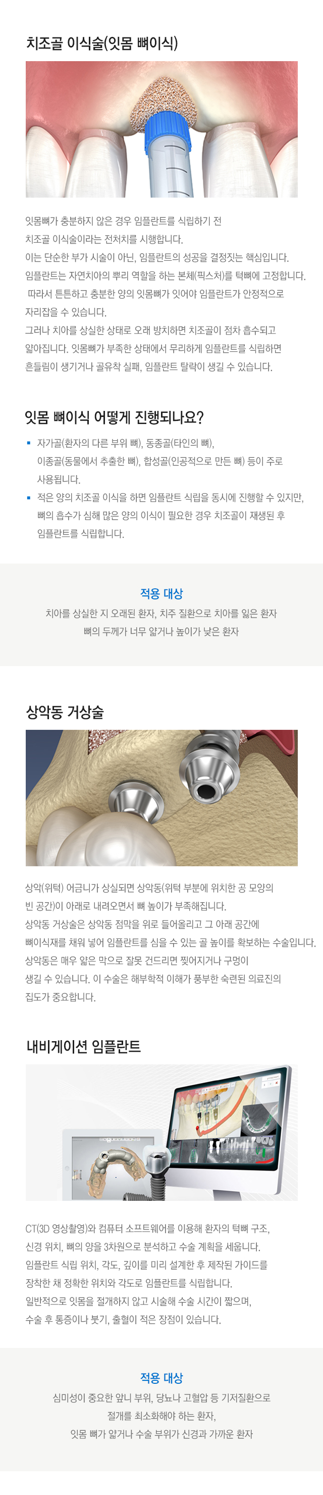 임플란트 수술