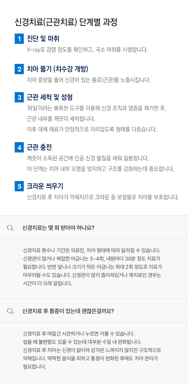 신경치료(근관치료) 단계별 과정