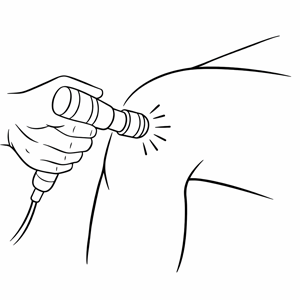 체외충격파 과정 02