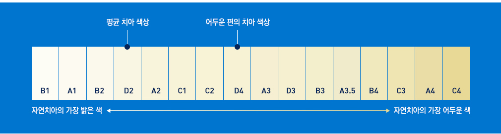 치아 색상 단계