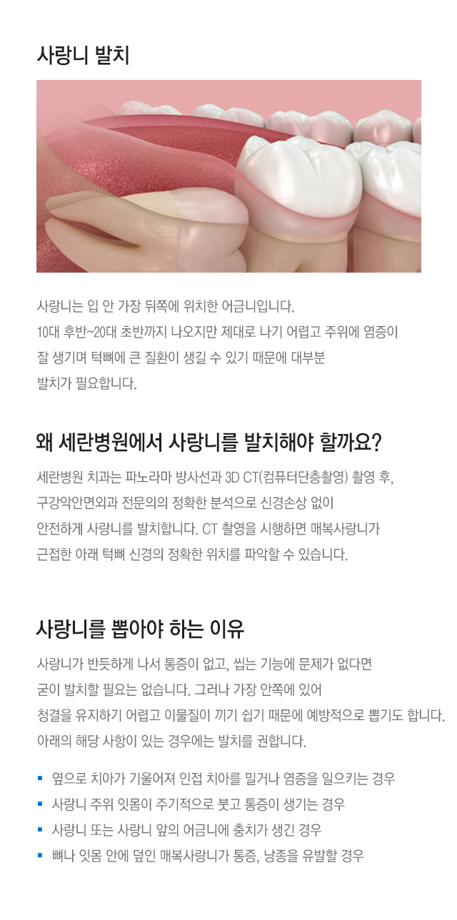 사랑니를 뽑아야 하는 이유