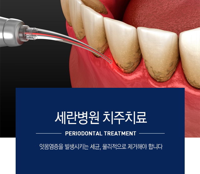 치주치료란